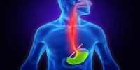 علائم رفلاکس معده چیست؟ + فیلم