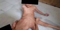 تصاویر باورنکردنی از دوقلوهایی با سه پا و چهار دست