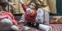 گزارش تکان دهنده وزارت بهداشت فلسطین از تعداد قطع عضو در نوار غزه