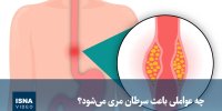 ویدیو/ چه عواملی باعث سرطان مری می‌شود؟