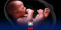 با طرح نفس ۱۵ هزار جنین که قرار بود نباشند، اکنون مرحله بارداری هستند