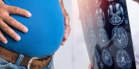 ویدیو/ چاقی، روند پیری مغز را تسریع می‌کند