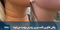 ویدیو/ وقتی فناوری باعث پیری زودرس پوست می‌شود!
