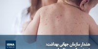 ویدیو/ هشدار سازمان جهانی بهداشت؛ شیوع جهانی سرخک با سرعت