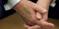 کبودی خبرساز روی دست ترامپ / آیا ترامپ سالم است؟ / کاخ سفید: کبودی ناشی از دست دادن زیاد است