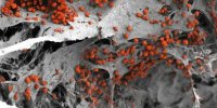 فناوری به کمک درمان سرطان خون آمد | ساخت نخستین نمونه انسانی «مغز استخوان» در آزمایشگاه