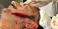 ۵۰ درصد از صورتم با تیزی قمه‌ فلج کردند | صحنه بازسازی شده حمله قمه‌کش یه شهروند بابلی را ببینید