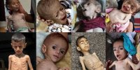 غزه و سلاح آمریکایی «گرسنگی»