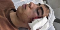 ضرب‌وشتم دانش‌آموز با دسته صندلی / روایت پدر از خشونت علیه فرزندش در دبیرستان دهبکری بم / آموزش‌وپرورش وعده پیگیری داد + عکس