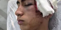ورود دادستانی بم به پرونده تنبیه بدنی دانش‌آموز در دهبکری + عکس