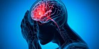ارتباط میگرن با یک عارضه خطرناک در میانسالی