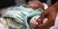 تصویر تولد کم‌سابقه پسر ۵کیلو و ۶۵۰ گرمی در کرمانشاه