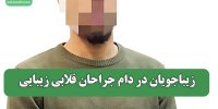 زیباجویان در دام جراحان قلابی زیبایی