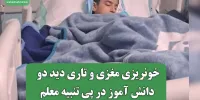 خونریزی مغزی و تاری دید دو دانش آموز در پی تنبیه معلم
