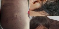 کودک آزارى بی رحمانه در ارومیه توسط نامادری+عکس