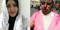 ماجرای مجازات اسیدپاشی چیست
