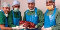 پزشکان کلیه 7 کیلویی پیرمرد هندی را خارج کردند