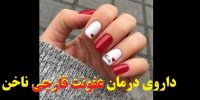 داروی درمان عفونت قارچی ناخن