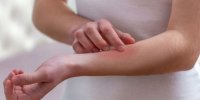 کرونا و تاثیرات آن بر پوست