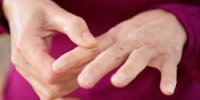 سندرم رینود چیست؟