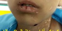 ماجرای تلخ کودک آزاری دانیال 9 ساله در سبزوار