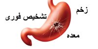 جدیدترین علامت زخم معده