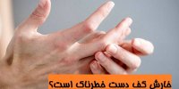 خارش کف دست خطرناک است؟