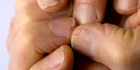 چگونه از شکستن ناخن جلوگیری کنیم؟