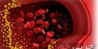 چگونه بفهمیم چربی خون بالایی داریم؟+علائم و راه‌های پیشگیری و درمان