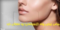 جراحی زیبایی چانه (ژینوپلاستی) چه خطراتی دارد؟