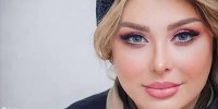 ماجرای عمل زیبایی جدید نیوشا ضیغمی