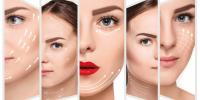 لیفت با نخ چگونه کار می کند؟ هزینه، رویه و عوارض جانبی