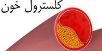 سریع ترین راه کاهش کلسترول خون