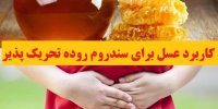 کاربرد عسل برای سندروم روده تحریک پذیر