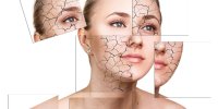 بهترین شستشوی صورت برای پوست های خشک کدام است؟