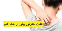 علت خارش بیش از حد کمر