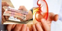 شرایط دریافت وام 50 میلیونی برای بیماران کلیوی