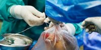 اقدام ایثارگرانه زن کرمانشاهی پس از فوت