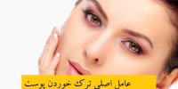 عامل اصلی ترک خوردن پوست چیست؟