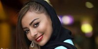 ماجرای کبودی و کتک کاری نفیسه روشن توسط شوهرش+ عکس