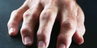 چگونه با آرتریت روماتوئید بهتر بخوابیم؟