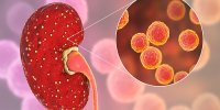 آیا عفونت ادراری می تواند به عفونت کلیه تبدیل شود؟