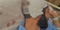 ماجرای ضرب و شتم دو روحانی در قم با لوله آهنی