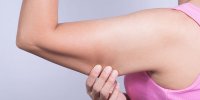 هزینه جراحی لیفت بازو چقدر است/ لیفت بازو برای چه کسانی مناسب است؟
