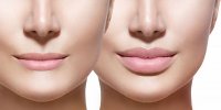 تزریق بوتاکس لب چگونه است؟