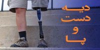 نرخ دیه دست و پا در سال 1401 چقدر است؟