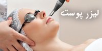 هزینه ی لیزر پوست در سال 1401 چقدر است؟