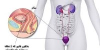 همه چیز درباره عفونت مثانه