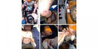 زخمی شدن پنج نفر بر اثر حمله سگ های ولگرد در مرند