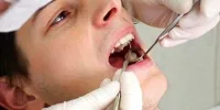 رمزگشایی از ارتباط بین بهداشت ضعیف دهان و دندان و آلزایمر